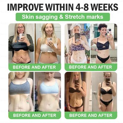 UK𝑪𝒍𝒊𝒏𝒊𝒄𝒂𝒍𝒍𝒚 𝑷𝒓𝒐𝒗𝒆𝒏 | 𝑶𝒇𝒇𝒊𝒄𝒊𝒂𝒍 𝑺𝒕𝒐𝒓𝒆 | 𝑩𝒖𝒊𝒍𝒅𝑳𝒆𝒂𝒇®𝐁𝐞𝐫𝒃𝒆𝒓𝒊𝒏𝒆 & 𝐆𝐋𝐏-𝟏 𝑷𝒓𝒐 𝑾𝒆𝒊𝒈𝒉𝒕 𝑳𝒐𝒔𝒔 𝑶𝒓𝒂𝒍 𝑺𝒐𝒍𝒖𝒕𝒊𝒐𝒏 𝗍𝖺𝗋𝗀𝖾𝗍𝗌 𝑡𝑢𝑏𝑏𝑜𝑟𝑛 𝑤𝑒𝑖𝑔ℎ𝑡, ℎ𝑖𝑔ℎ 𝑏𝑙𝑜𝑜𝑑 𝑝𝑟𝑒𝑠𝑠𝑢𝑟𝑒, 𝑏𝑙𝑜𝑜𝑑 𝑠𝑢𝑔𝑎𝑟 ,𝘧𝘢𝘵𝘵𝘺 𝘭𝘪𝘷𝘦𝘳, 𝘫𝘰𝘪𝘯𝘵 𝘱𝘢𝘪𝘯, 𝘧𝘢𝘵𝘪𝘨𝘶𝘦,𝑙𝑜𝑤 𝑒𝑛𝑒𝑟𝑔𝑦, 𝑠𝑎𝑔𝑔𝑖𝑛𝑔 𝑠𝑘𝑖𝑛 & 𝑚𝑜𝑟𝑒 𝑓𝑜𝑟 𝑏𝑒𝑡𝑡𝑒𝑟 ℎ𝑒𝑎𝑙𝑡ℎ & 𝑣𝑖𝑡𝑎𝑙𝑖𝑡𝑦