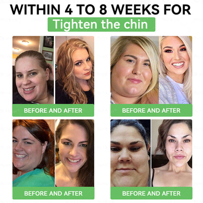 UK𝑪𝒍𝒊𝒏𝒊𝒄𝒂𝒍𝒍𝒚 𝑷𝒓𝒐𝒗𝒆𝒏 | 𝑶𝒇𝒇𝒊𝒄𝒊𝒂𝒍 𝑺𝒕𝒐𝒓𝒆 | 𝑩𝒖𝒊𝒍𝒅𝑳𝒆𝒂𝒇®𝐁𝐞𝐫𝒃𝒆𝒓𝒊𝒏𝒆 & 𝐆𝐋𝐏-𝟏 𝑷𝒓𝒐 𝑾𝒆𝒊𝒈𝒉𝒕 𝑳𝒐𝒔𝒔 𝑶𝒓𝒂𝒍 𝑺𝒐𝒍𝒖𝒕𝒊𝒐𝒏 𝗍𝖺𝗋𝗀𝖾𝗍𝗌 𝑡𝑢𝑏𝑏𝑜𝑟𝑛 𝑤𝑒𝑖𝑔ℎ𝑡, ℎ𝑖𝑔ℎ 𝑏𝑙𝑜𝑜𝑑 𝑝𝑟𝑒𝑠𝑠𝑢𝑟𝑒, 𝑏𝑙𝑜𝑜𝑑 𝑠𝑢𝑔𝑎𝑟 ,𝘧𝘢𝘵𝘵𝘺 𝘭𝘪𝘷𝘦𝘳, 𝘫𝘰𝘪𝘯𝘵 𝘱𝘢𝘪𝘯, 𝘧𝘢𝘵𝘪𝘨𝘶𝘦,𝑙𝑜𝑤 𝑒𝑛𝑒𝑟𝑔𝑦, 𝑠𝑎𝑔𝑔𝑖𝑛𝑔 𝑠𝑘𝑖𝑛 & 𝑚𝑜𝑟𝑒 𝑓𝑜𝑟 𝑏𝑒𝑡𝑡𝑒𝑟 ℎ𝑒𝑎𝑙𝑡ℎ & 𝑣𝑖𝑡𝑎𝑙𝑖𝑡𝑦