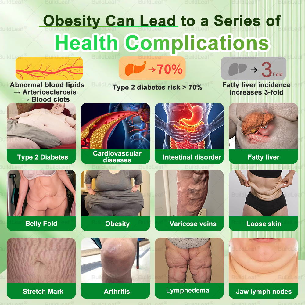 𝖮𝖿𝖿𝗂𝖼𝗂𝖺𝗅 𝖲𝗍𝗈𝗋𝖾 | 𝘽𝙪𝙞𝙡𝙙𝙇𝙚𝙖𝙛® 𝗚𝗟𝗣-𝟭 𝟐𝟎-𝗶𝗻-𝟭 𝗦𝗹𝗶𝗺 & 𝑯𝒆𝒂𝒍𝒕𝒉 𝑶𝒓𝒂𝒍 𝑺𝒐𝒍𝒖𝒕𝒊𝒐𝒏 (𝑱𝒖𝒔𝒕 𝒐𝒏𝒄𝒆 𝒂 𝒅𝒂𝒚, 𝘃𝗶𝘀𝗶𝗯𝗹𝗲 𝗰𝗵𝗮𝗻𝗴𝗲𝘀 𝗶𝗻 𝟳 𝗱𝗮𝘆𝘀 ✅ 𝘍𝘰𝘳 𝘰𝘣𝘦𝘴𝘪𝘵𝘺, 𝘤𝘢𝘳𝘥𝘪𝘰𝘷𝘢𝘴𝘤𝘶𝘭𝘢𝘳 𝘩𝘦𝘢𝘭𝘵𝘩,𝙙𝙞𝙖𝙗𝙚𝙩𝙚𝙨, 𝙨𝙡𝙚𝙚𝙥 𝐚𝐩𝐧𝐞𝐚, 𝐆𝐮𝐭 𝐇𝐞𝐚𝐥𝐭𝐡, 𝐣𝐨𝐢𝐧𝐭 𝐢𝐬𝐬𝐮𝐞𝐬, 𝐚𝐧𝐝 𝐦𝐨𝐫𝐞