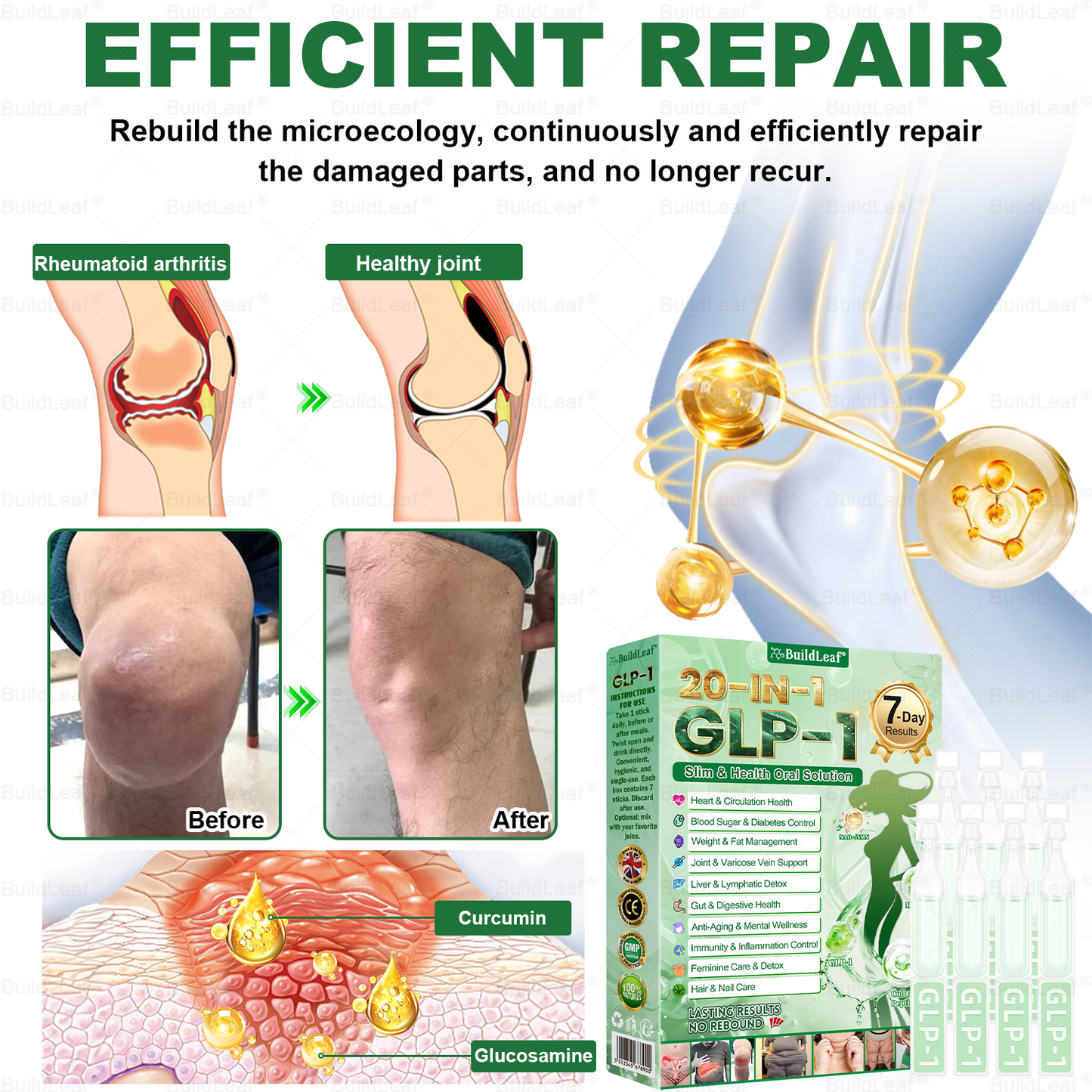 𝖮𝖿𝖿𝗂𝖼𝗂𝖺𝗅 𝖲𝗍𝗈𝗋𝖾 | 𝘽𝙪𝙞𝙡𝙙𝙇𝙚𝙖𝙛® 𝗚𝗟𝗣-𝟭 𝟐𝟎-𝗶𝗻-𝟭 𝗦𝗹𝗶𝗺 & 𝑯𝒆𝒂𝒍𝒕𝒉 𝑶𝒓𝒂𝒍 𝑺𝒐𝒍𝒖𝒕𝒊𝒐𝒏 (𝑱𝒖𝒔𝒕 𝒐𝒏𝒄𝒆 𝒂 𝒅𝒂𝒚, 𝘃𝗶𝘀𝗶𝗯𝗹𝗲 𝗰𝗵𝗮𝗻𝗴𝗲𝘀 𝗶𝗻 𝟳 𝗱𝗮𝘆𝘀 ✅ 𝘍𝘰𝘳 𝘰𝘣𝘦𝘴𝘪𝘵𝘺, 𝘤𝘢𝘳𝘥𝘪𝘰𝘷𝘢𝘴𝘤𝘶𝘭𝘢𝘳 𝘩𝘦𝘢𝘭𝘵𝘩,𝙙𝙞𝙖𝙗𝙚𝙩𝙚𝙨, 𝙨𝙡𝙚𝙚𝙥 𝐚𝐩𝐧𝐞𝐚, 𝐆𝐮𝐭 𝐇𝐞𝐚𝐥𝐭𝐡, 𝐣𝐨𝐢𝐧𝐭 𝐢𝐬𝐬𝐮𝐞𝐬, 𝐚𝐧𝐝 𝐦𝐨𝐫𝐞