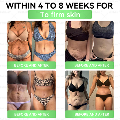 𝖮𝖿𝖿𝗂𝖼𝗂𝖺𝗅 𝖲𝗍𝗈𝗋𝖾 | 𝘽𝙪𝙞𝙡𝙙𝙇𝙚𝙖𝙛® 𝗚𝗟𝗣-𝟭 𝟐𝟎-𝗶𝗻-𝟭 𝗦𝗹𝗶𝗺 & 𝑯𝒆𝒂𝒍𝒕𝒉 𝑶𝒓𝒂𝒍 𝑺𝒐𝒍𝒖𝒕𝒊𝒐𝒏 (𝑱𝒖𝒔𝒕 𝒐𝒏𝒄𝒆 𝒂 𝒅𝒂𝒚, 𝘃𝗶𝘀𝗶𝗯𝗹𝗲 𝗰𝗵𝗮𝗻𝗴𝗲𝘀 𝗶𝗻 𝟳 𝗱𝗮𝘆𝘀 ✅ 𝘍𝘰𝘳 𝘰𝘣𝘦𝘴𝘪𝘵𝘺, 𝘤𝘢𝘳𝘥𝘪𝘰𝘷𝘢𝘴𝘤𝘶𝘭𝘢𝘳 𝘩𝘦𝘢𝘭𝘵𝘩,𝙙𝙞𝙖𝙗𝙚𝙩𝙚𝙨, 𝙨𝙡𝙚𝙚𝙥 𝐚𝐩𝐧𝐞𝐚, 𝐆𝐮𝐭 𝐇𝐞𝐚𝐥𝐭𝐡, 𝐣𝐨𝐢𝐧𝐭 𝐢𝐬𝐬𝐮𝐞𝐬, 𝐚𝐧𝐝 𝐦𝐨𝐫𝐞