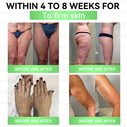 𝐎𝐟𝐟𝐢𝐜𝐢𝐚𝐥 𝐒𝐭𝐨𝐫𝐞 | 𝘽𝙪𝙞𝙡𝙙𝙇𝙚𝙖𝙛® 𝗚𝗟𝗣-𝟭 8-𝐢𝐧-𝟏 𝐒𝐥𝐢𝐦 & 𝐇𝐞𝐚𝐥𝐭𝐡 𝐎𝐫𝐚𝐥 𝐒𝐨𝐥𝐮𝐭𝐢𝐨𝐧 (𝑶𝒏𝒄𝒆 𝒂 𝒅𝒂𝒚, 𝒓𝒆𝒔𝒖𝒍𝒕𝒔 𝒊𝒏 7 𝒅𝒂𝒚𝒔), 𝑾𝒊𝒕𝒉 100 𝑩𝒊𝒍𝒍𝒊𝒐𝒏 𝑪𝑭𝑼 𝑨𝒄𝒕𝒊𝒗𝒆 𝑷𝒓𝒐𝒃𝒊𝒐𝒕𝒊𝒄𝒔 ✅ 𝑺𝒖𝒑𝒑𝒐𝒓𝒕𝒔 𝒘𝒆𝒊𝒈𝒉𝒕 𝒎𝒂𝒏𝒂𝒈𝒆𝒎𝒆𝒏𝒕, 𝒉𝒆𝒂𝒓𝒕 𝒉𝒆𝒂𝒍𝒕𝒉, 𝒅𝒊𝒂𝒃𝒆𝒕𝒆𝒔, 𝒈𝒖𝒕 & 𝒘𝒐𝒎𝒆𝒏’𝒔 𝒉𝒆𝒂𝒍𝒕𝒉, 𝒘𝒉𝒊𝒍𝒆 𝒇𝒊𝒓𝒎𝒊𝒏𝒈 𝒔𝒌𝒊𝒏 & 𝒃𝒐𝒐𝒔𝒕𝒊𝒏𝒈 𝒆𝒏𝒆𝒓𝒈𝒚.