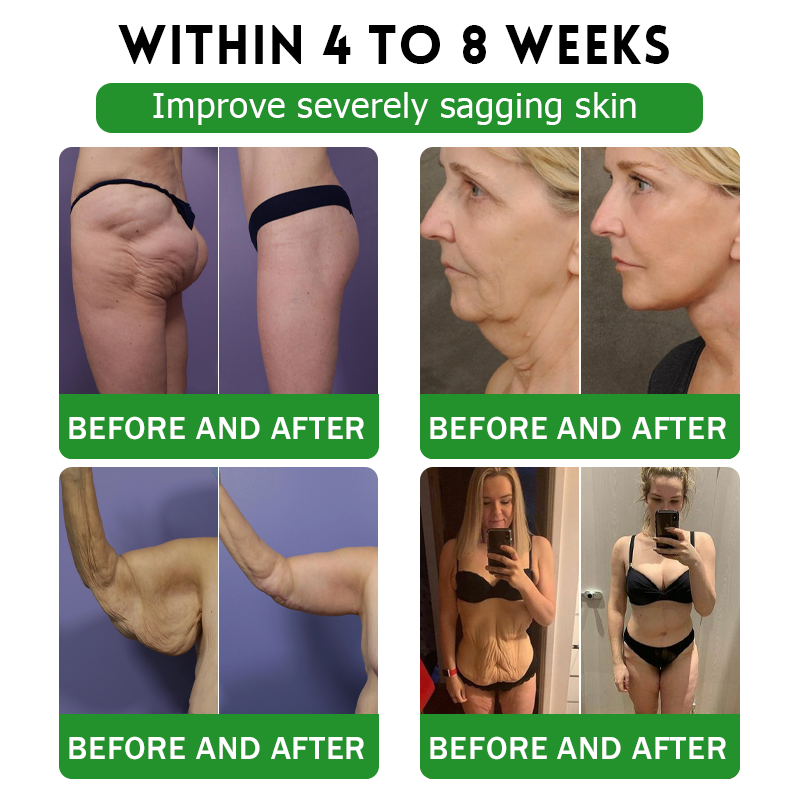 UK Official Store | 𝑩𝒖𝒊𝒍𝒅𝑳𝒆𝒂𝒇® 𝐆𝐋𝐏-𝟏 𝟔-𝐢𝐧-𝟏 𝑯𝒆𝒂𝒍𝒕𝒉 𝑺𝒐𝒍𝒖𝒕𝒊𝒐𝒏 𝑶𝒓𝒂𝒍 𝑳𝒊𝒒𝒖𝒊𝒅 (𝑱𝒖𝒔𝒕 𝒐𝒏𝒄𝒆 𝒂 𝒅𝒂𝒚, 𝘃𝗶𝘀𝗶𝗯𝗹𝗲 𝗰𝗵𝗮𝗻𝗴𝗲𝘀 𝗶𝗻 𝟳 𝗱𝗮𝘆𝘀) ✅ 𝘍𝘰𝘳 𝘰𝘣𝘦𝘴𝘪𝘵𝘺, 𝘤𝘢𝘳𝘥𝘪𝘰𝘷𝘢𝘴𝘤𝘶𝘭𝘢𝘳 𝘩𝘦𝘢𝘭𝘵𝘩, 𝙙𝙞𝙖𝙗𝙚𝙩𝙚𝙨, 𝙨𝙡𝙚𝙚𝙥 𝐚𝐩𝐧𝐞𝐚, 𝐆𝐮𝐭 𝐇𝐞𝐚𝐥𝐭𝐡, 𝐣𝐨𝐢𝐧𝐭 𝐢𝐬𝐬𝐮𝐞𝐬, 𝐚𝐧𝐝 𝐦𝐨𝐫𝐞