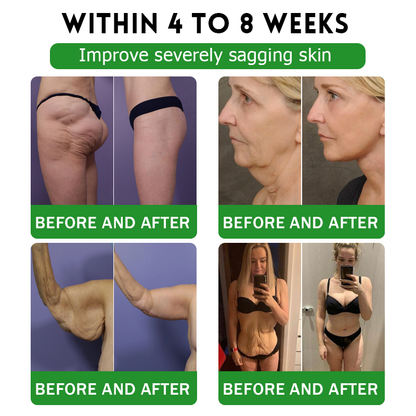 UK Official Store | 𝑩𝒖𝒊𝒍𝒅𝑳𝒆𝒂𝒇® 𝐆𝐋𝐏-𝟏 𝟔-𝐢𝐧-𝟏 𝑯𝒆𝒂𝒍𝒕𝒉 𝑺𝒐𝒍𝒖𝒕𝒊𝒐𝒏 𝑶𝒓𝒂𝒍 𝑳𝒊𝒒𝒖𝒊𝒅 (𝑱𝒖𝒔𝒕 𝒐𝒏𝒄𝒆 𝒂 𝒅𝒂𝒚, 𝘃𝗶𝘀𝗶𝗯𝗹𝗲 𝗰𝗵𝗮𝗻𝗴𝗲𝘀 𝗶𝗻 𝟳 𝗱𝗮𝘆𝘀) ✅ 𝘍𝘰𝘳 𝘰𝘣𝘦𝘴𝘪𝘵𝘺, 𝘤𝘢𝘳𝘥𝘪𝘰𝘷𝘢𝘴𝘤𝘶𝘭𝘢𝘳 𝘩𝘦𝘢𝘭𝘵𝘩, 𝙙𝙞𝙖𝙗𝙚𝙩𝙚𝙨, 𝙨𝙡𝙚𝙚𝙥 𝐚𝐩𝐧𝐞𝐚, 𝐆𝐮𝐭 𝐇𝐞𝐚𝐥𝐭𝐡, 𝐣𝐨𝐢𝐧𝐭 𝐢𝐬𝐬𝐮𝐞𝐬, 𝐚𝐧𝐝 𝐦𝐨𝐫𝐞